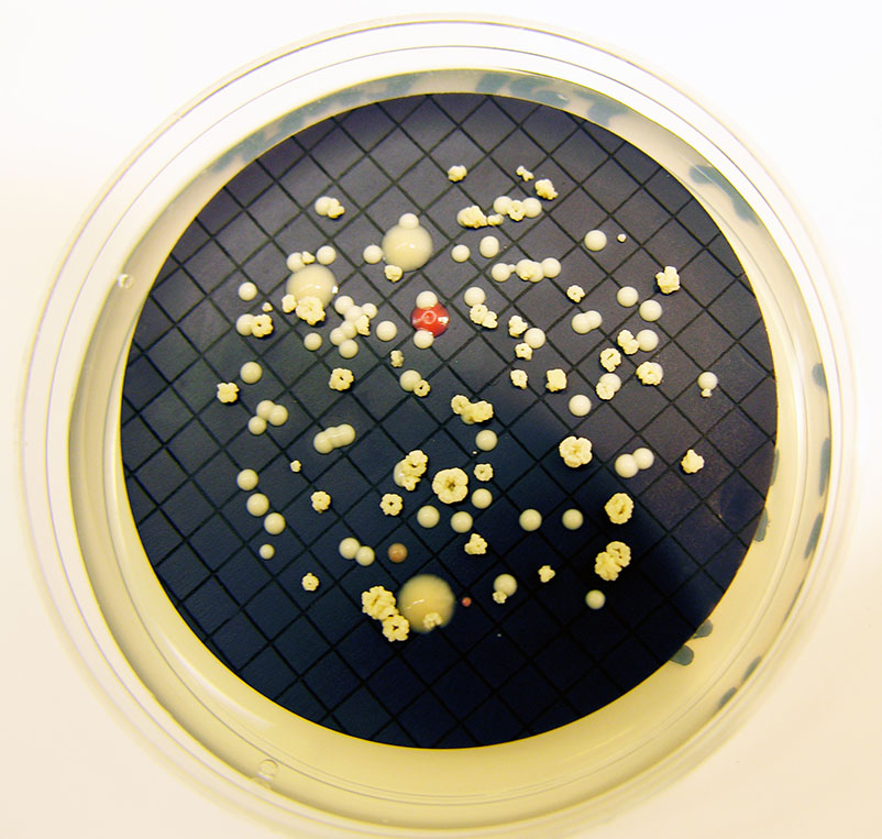Growth of Mycobacterium isolated on a plate of culture medium. (Photo: Stacey Pfaller, EPA)