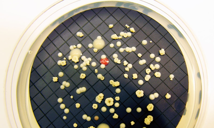 Growth of Mycobacterium isolated on a plate of culture medium. (Photo: Stacey Pfaller, EPA)