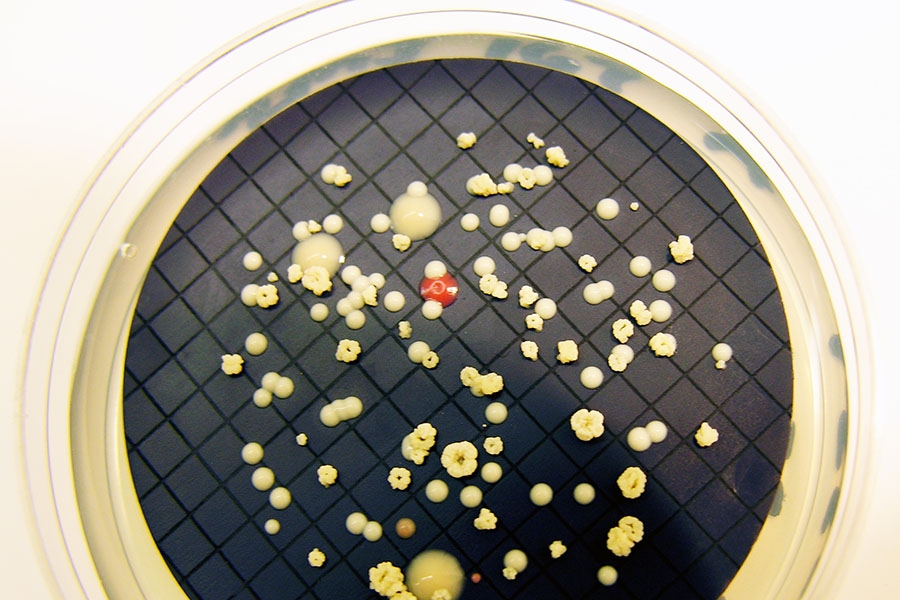 Growth of Mycobacterium isolated on a plate of culture medium. (Photo: Stacey Pfaller, EPA)